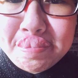 舌头放血视频,传统养生法背后的科学原理